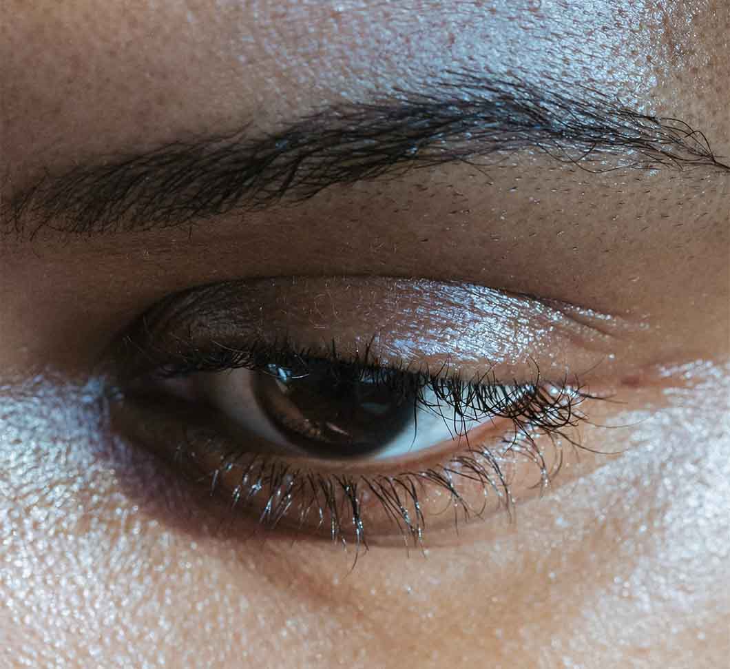 Girl with eye showing that iron levels needs to be checked